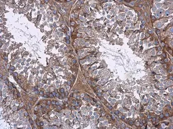 Immunohistochemistry (Formalin/PFA-fixed paraffin-embedded sections) - Anti-mTOR antibody - C-terminal (AB137341)