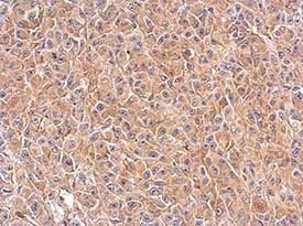 Immunohistochemistry (Formalin/PFA-fixed paraffin-embedded sections) - Anti-mTOR antibody - C-terminal (AB137341), expandable thumbnail