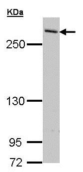 Western blot - Anti-mTOR antibody - C-terminal (AB137341), expandable thumbnail