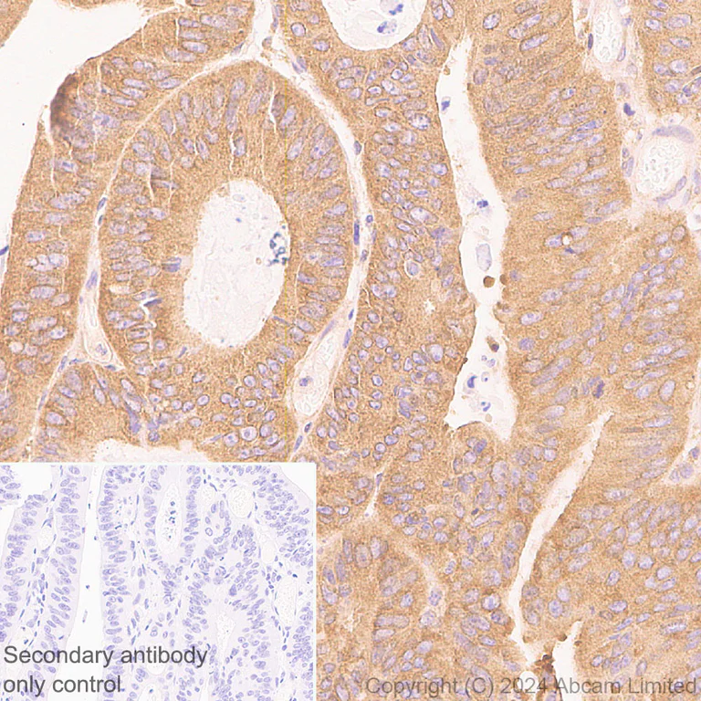 Immunohistochemistry (Formalin/PFA-fixed paraffin-embedded sections) - Anti-mTOR antibody [EPR18152-71] - BSA and Azide free (Detector) (AB242766)
