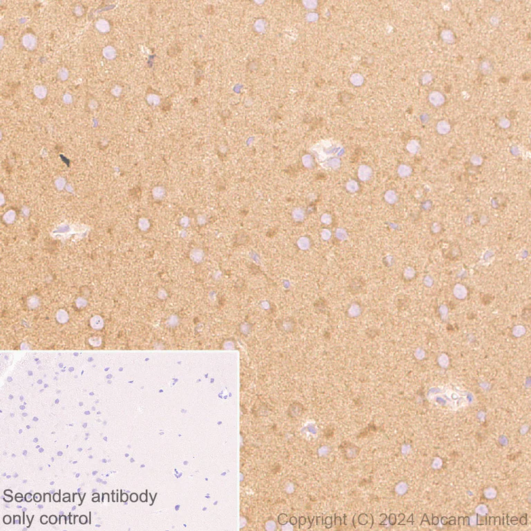 Immunohistochemistry (Formalin/PFA-fixed paraffin-embedded sections) - Anti-mTOR antibody [EPR18152-71] - BSA and Azide free (Detector) (AB242766)