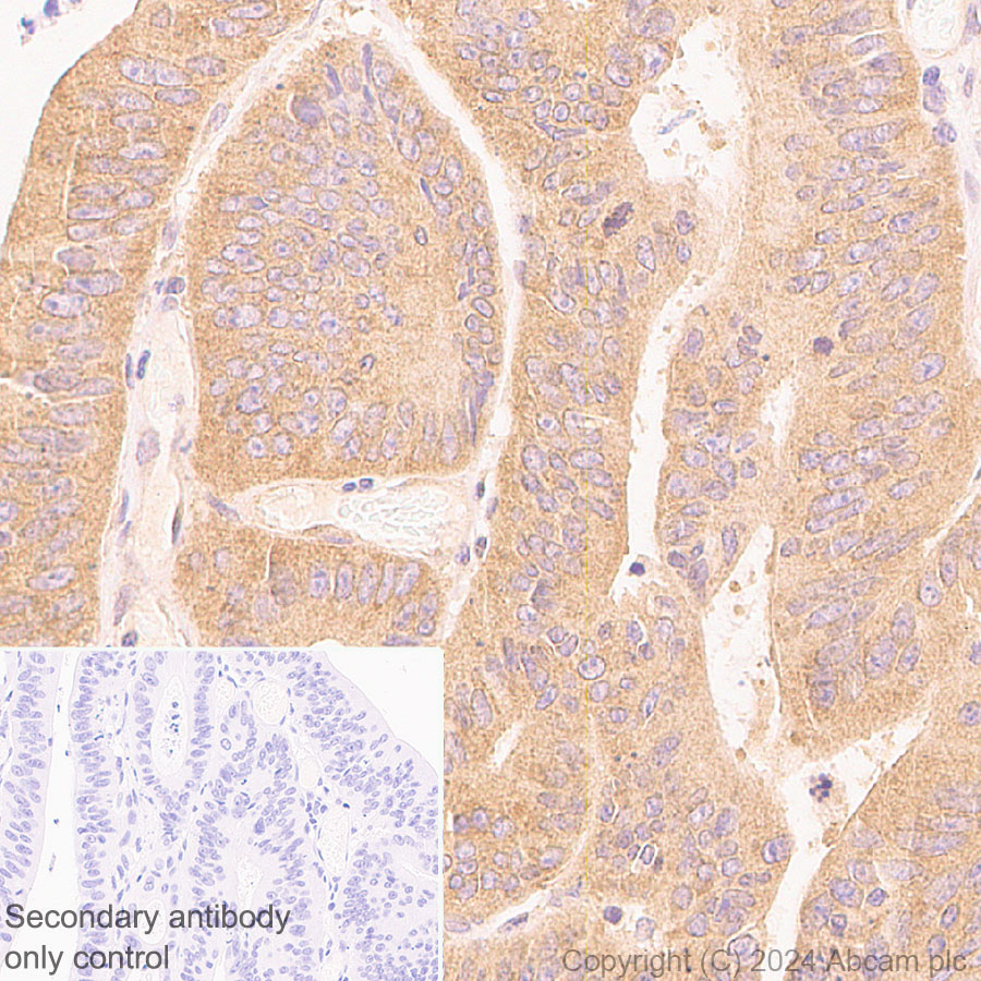 Immunohistochemistry (Formalin/PFA-fixed paraffin-embedded sections) - Anti-mTOR antibody [EPR390(N)] (ab134903), expandable thumbnail