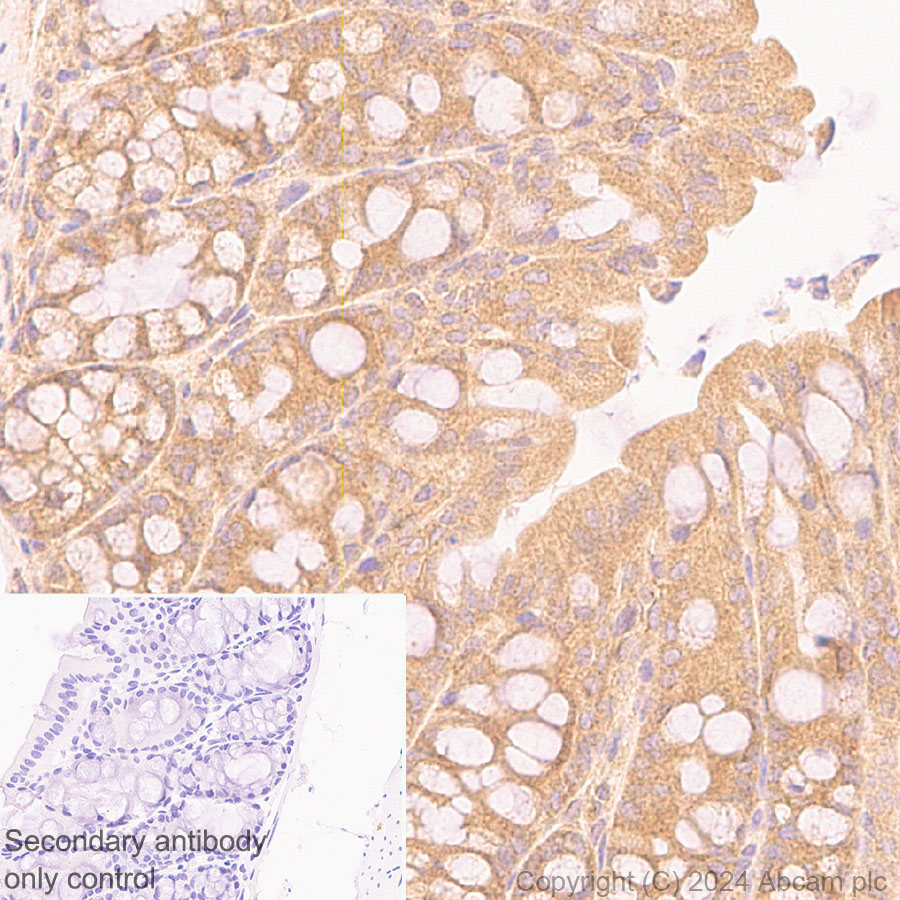 Immunohistochemistry (Formalin/PFA-fixed paraffin-embedded sections) - Anti-mTOR antibody [EPR390(N)] (AB134903), expandable thumbnail