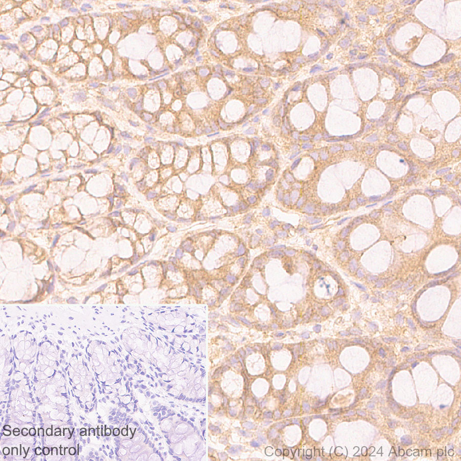 Immunohistochemistry (Formalin/PFA-fixed paraffin-embedded sections) - Anti-mTOR antibody [EPR390(N)] (ab134903), expandable thumbnail