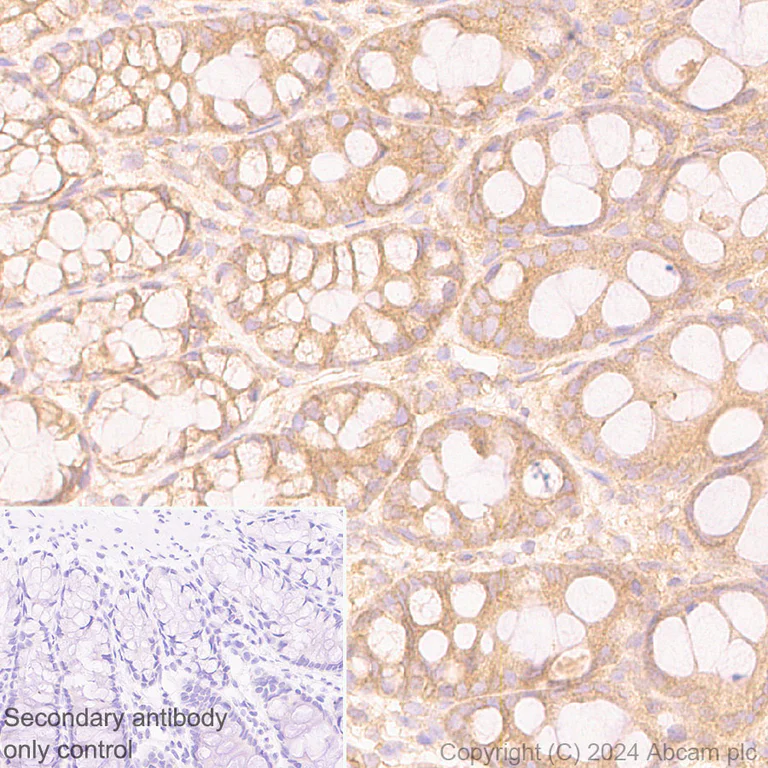 Immunohistochemistry (Formalin/PFA-fixed paraffin-embedded sections) - Anti-mTOR antibody [EPR390(N)] (AB134903)