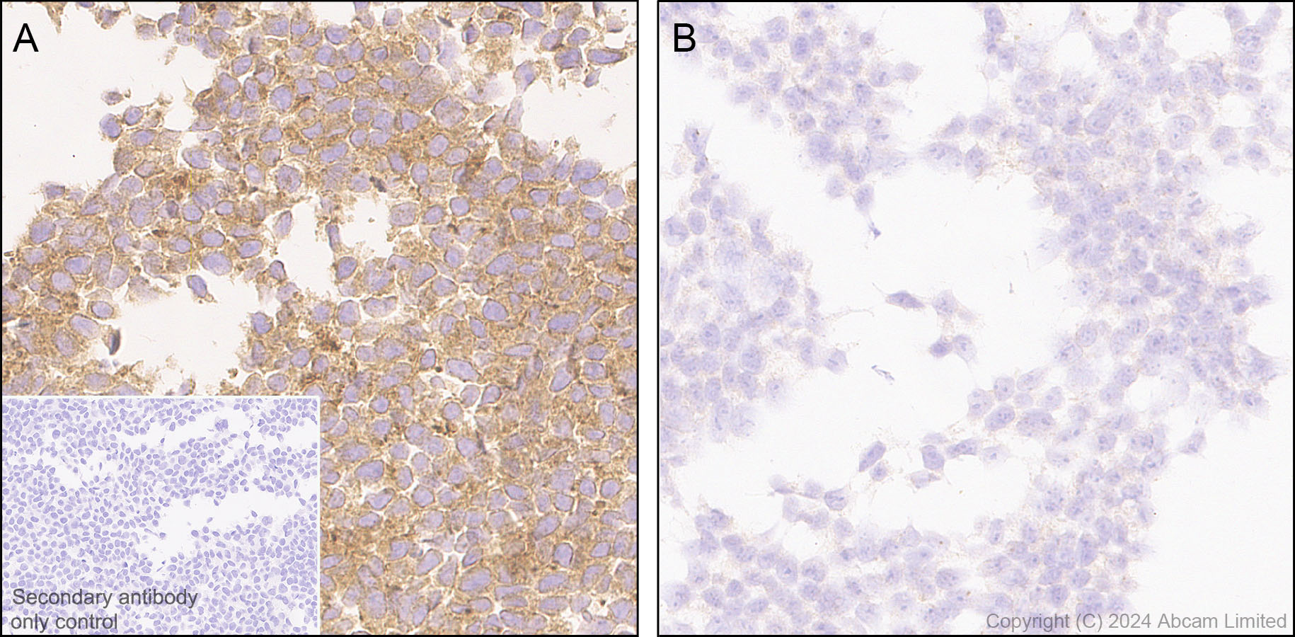 Immunohistochemistry (Formalin/PFA-fixed paraffin-embedded sections) - Anti-mTOR antibody [EPR390(N)] (ab134903), expandable thumbnail