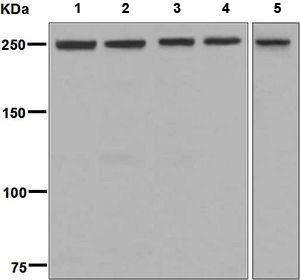 Western blot - Anti-mTOR antibody [EPR390(N)] (AB134903), expandable thumbnail