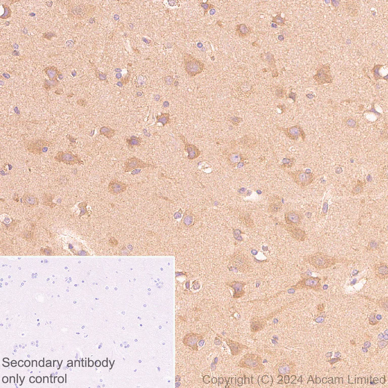 Immunohistochemistry (Formalin/PFA-fixed paraffin-embedded sections) - Anti-mTOR antibody [RM1258] (AB322444)