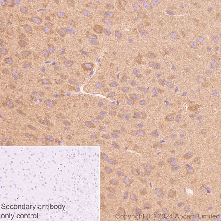 Immunohistochemistry (Formalin/PFA-fixed paraffin-embedded sections) - Anti-mTOR antibody [RM1258] (AB322444)