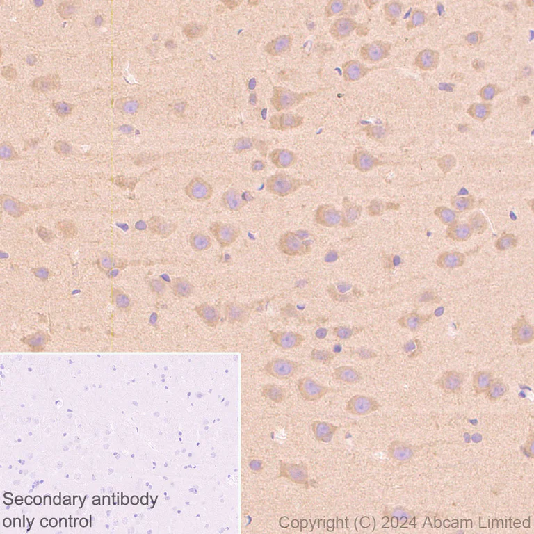Immunohistochemistry (Formalin/PFA-fixed paraffin-embedded sections) - Anti-mTOR antibody [RM1258] (AB322444)