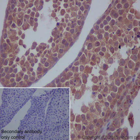 Immunohistochemistry (Formalin/PFA-fixed paraffin-embedded sections) - Anti-mTOR antibody [Y391] (AB32028)