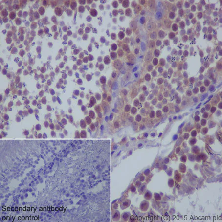 Immunohistochemistry (Formalin/PFA-fixed paraffin-embedded sections) - Anti-mTOR antibody [Y391] - BSA and Azide free (AB218525)