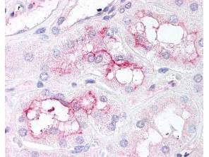 Immunohistochemistry (Formalin/PFA-fixed paraffin-embedded sections) - Anti-mTOR (phospho S2448) antibody (AB1093)