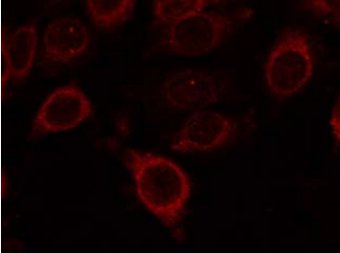 Immunocytochemistry/ Immunofluorescence - Anti-mTOR (phospho S2448) antibody (AB131538), expandable thumbnail