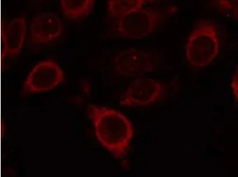 Immunocytochemistry/ Immunofluorescence - Anti-mTOR (phospho S2448) antibody (AB131538)