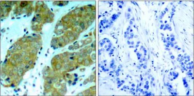 Immunohistochemistry (Formalin/PFA-fixed paraffin-embedded sections) - Anti-mTOR (phospho S2448) antibody (AB131538)