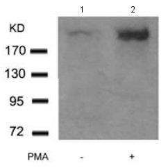 Western blot - Anti-mTOR (phospho S2448) antibody (AB131538), expandable thumbnail