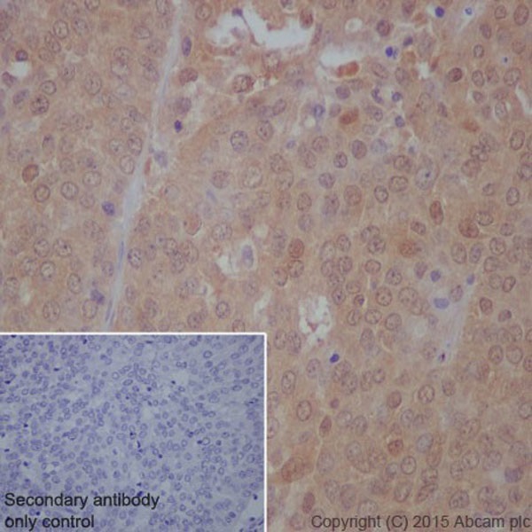 Immunohistochemistry (Formalin/PFA-fixed paraffin-embedded sections) - Anti-mTOR (phospho S2448) antibody [EPR426(2)] (ab109268), expandable thumbnail
