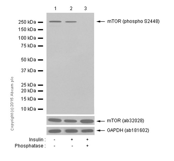 Western blot - Anti-mTOR (phospho S2448) antibody [EPR426(2)] (AB109268), expandable thumbnail