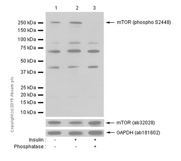 Western blot - Anti-mTOR (phospho S2448) antibody [EPR426(2)] (ab109268), expandable thumbnail