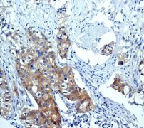 Immunohistochemistry (Formalin/PFA-fixed paraffin-embedded sections) - Anti-mTOR (phospho S2448) antibody [EPR426(2)] - BSA and Azide free (AB177734)