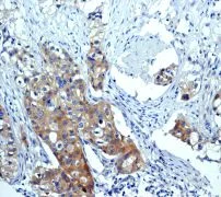 Immunohistochemistry (Formalin/PFA-fixed paraffin-embedded sections) - Anti-mTOR (phospho S2448) antibody [EPR426(2)] - BSA and Azide free (AB177734)