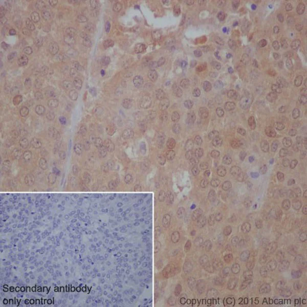 Immunohistochemistry (Formalin/PFA-fixed paraffin-embedded sections) - Anti-mTOR (phospho S2448) antibody [EPR426(2)] - BSA and Azide free (AB177734)