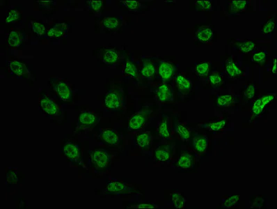 Immunocytochemistry/ Immunofluorescence - Anti-mTOR (phospho S2481) antibody [3H11] (AB314037)