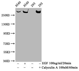 Western blot - Anti-mTOR (phospho S2481) antibody [3H11] (AB314037), expandable thumbnail