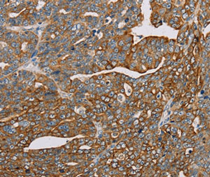 Immunohistochemistry (Formalin/PFA-fixed paraffin-embedded sections) - Anti-MTP18 antibody (AB198217), expandable thumbnail