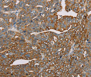 Immunohistochemistry (Formalin/PFA-fixed paraffin-embedded sections) - Anti-MTP18 antibody (AB198217)