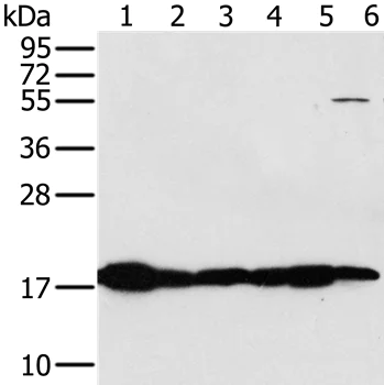 Western blot - Anti-MTP18 antibody (AB198217)