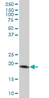 Western blot - Anti-MTP18 antibody (AB67254)