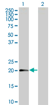 Western blot - Anti-MTP18 antibody (AB67254)