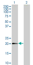 Western blot - Anti-MTP18 antibody (AB67254)