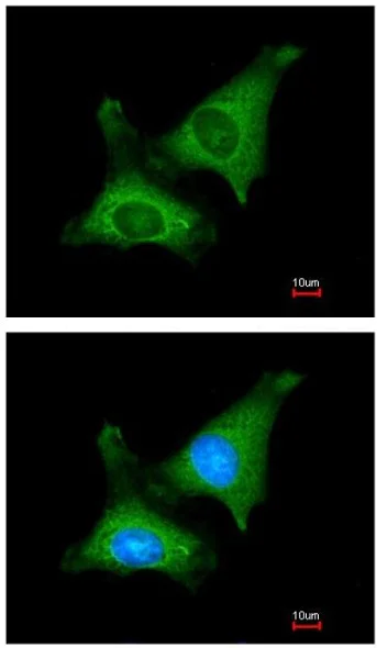 Immunocytochemistry/ Immunofluorescence - Anti-MTPAP antibody (AB154555)