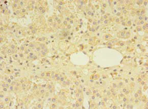 Immunohistochemistry (Formalin/PFA-fixed paraffin-embedded sections) - Anti-MTR antibody (AB238483)