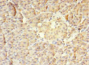 Immunohistochemistry (Formalin/PFA-fixed paraffin-embedded sections) - Anti-MTR antibody (AB238483)