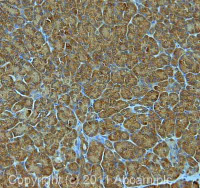 Immunohistochemistry (Formalin/PFA-fixed paraffin-embedded sections) - Anti-MTR antibody (AB66039)