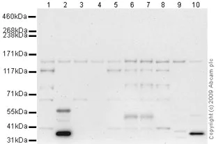 Western blot - Anti-MTR antibody (AB66039)