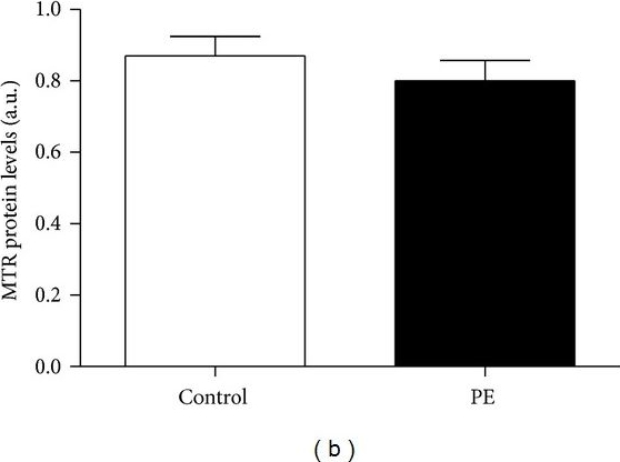 Western blot - Anti-MTR antibody (AB66039), expandable thumbnail