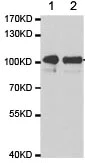 Western blot - Anti-MTR4 antibody (AB187884)
