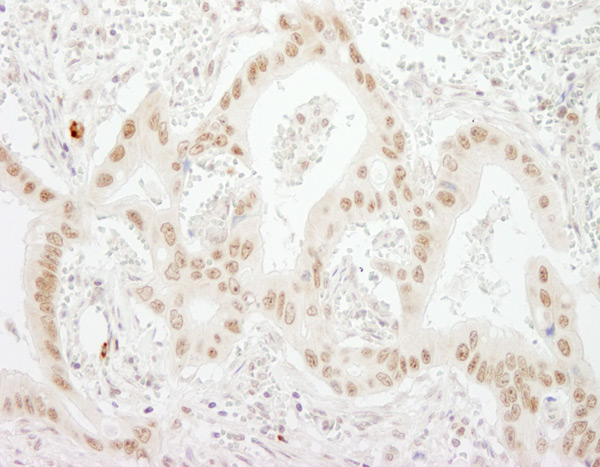 Immunohistochemistry (Formalin/PFA-fixed paraffin-embedded sections) - Anti-MTR4 antibody (AB70551), expandable thumbnail