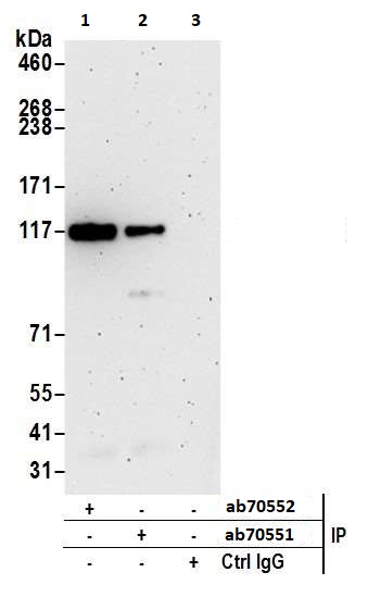 Immunoprecipitation - Anti-MTR4 antibody (AB70551), expandable thumbnail