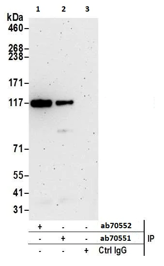 Immunoprecipitation - Anti-MTR4 antibody (AB70551)