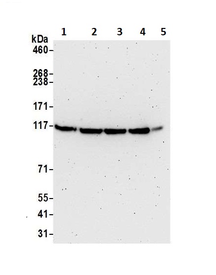 Western blot - Anti-MTR4 antibody (AB70551), expandable thumbnail