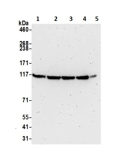 Western blot - Anti-MTR4 antibody (AB70551)