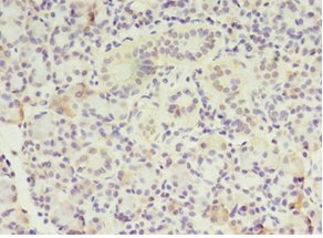 Immunohistochemistry (Formalin/PFA-fixed paraffin-embedded sections) - Anti-MTRR/MSR antibody (AB235354)