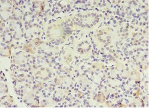 Immunohistochemistry (Formalin/PFA-fixed paraffin-embedded sections) - Anti-MTRR/MSR antibody (AB235354)
