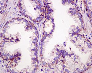 Immunohistochemistry (Formalin/PFA-fixed paraffin-embedded sections) - Anti-mtTFA antibody [EPR12285] - BSA and Azide free (ab240958), expandable thumbnail